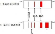 介绍下抗碱血红蛋白测定的原理是什么