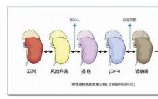 科普下早期肾损伤的检查与监测