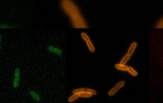 活细菌的实时画面有助于抗生素狩猎
