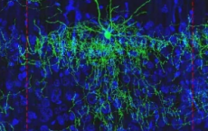 脑科学家在映射小鼠皮层方面取得了长足进步
