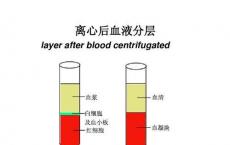 介绍下血细胞比容测定的临床意义是什么