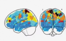 研究人员已经确定了患有躁狂症的儿童在休息期间大脑的连