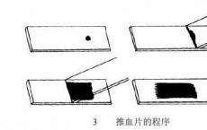 科普下涂片的制备方法是什么