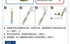 科普下粪便检验的化学检查是什么