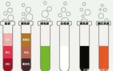 介绍下尿液细胞学检查的临床意义和注意事项有哪些