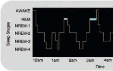 新研究证明了NREM睡眠慢波通过皮层解剖学联系在人脑中传播