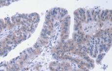 单克隆抗体mAB C617的详细临床前结果可用于治疗亨廷顿舞蹈病