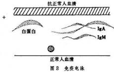 介绍下免疫固定电泳是什么