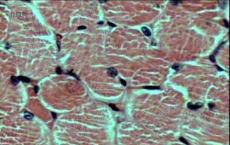 研究人员发现由干细胞产生的骨骼肌