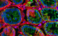 加速结肠癌研究的新模型