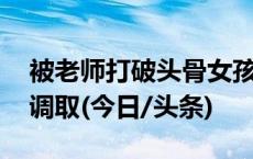 被老师打破头骨女孩已清醒 家属称监控无法调取(今日/头条)