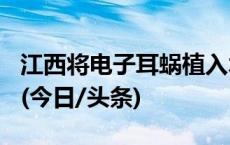 江西将电子耳蜗植入术等192个项目纳入医保(今日/头条)