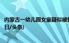 内蒙古一幼儿园女童疑似被扎？警方：现有证据不能证明(今日/头条)